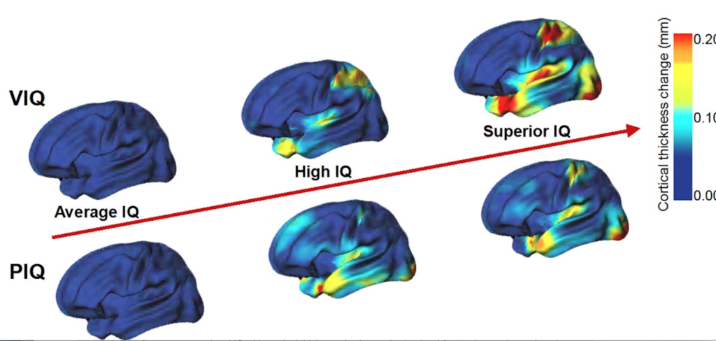 Heredity Studies of IQ — Brain measurements and scans - IQ Science for ...